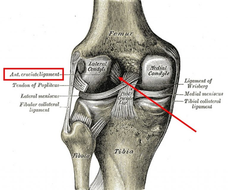 ACL attachments on the femur.